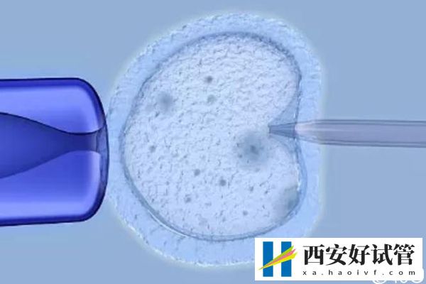 西安一代试管大概多少钱答案在这，附top10机构排名(图2)