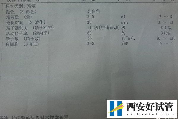 西安一代试管大概多少钱答案在这，附top10机构排名(图3)